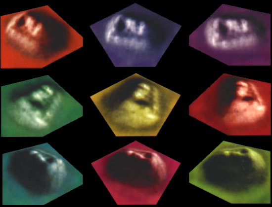 Carlotto's Shape From Shading Interpolation